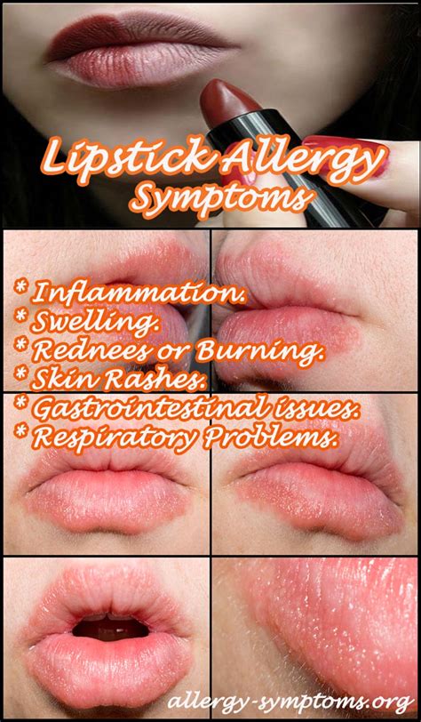 lipstick allergic reactions